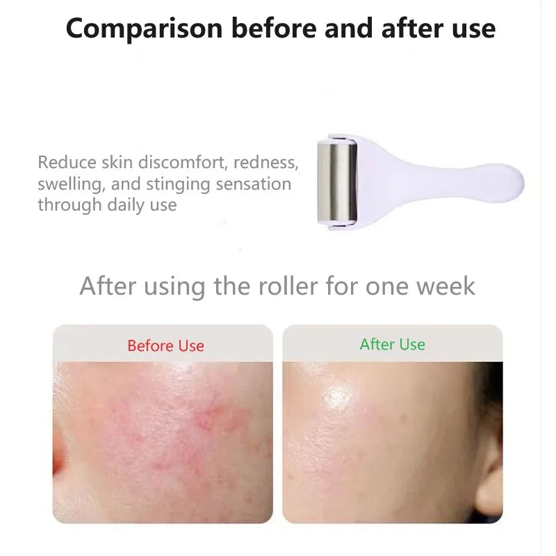 Ice Roller Massager Relieve Eye Face Puffiness Wrinkles Dark Circles Skin Cooling 304 Stainless Steel Roller Beauty Care Tool